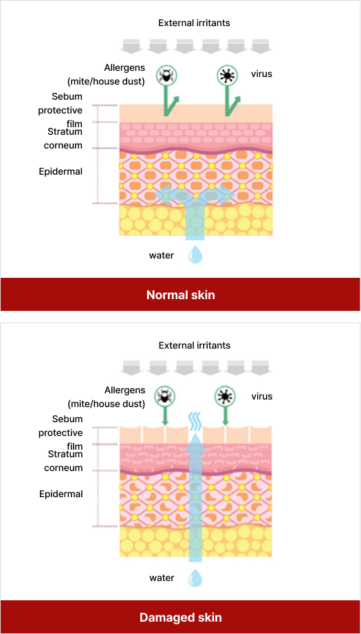 Ceramide