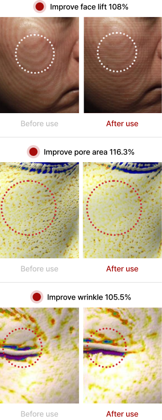 Nano Liposome