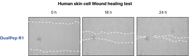 Human skin cell Wound healing test